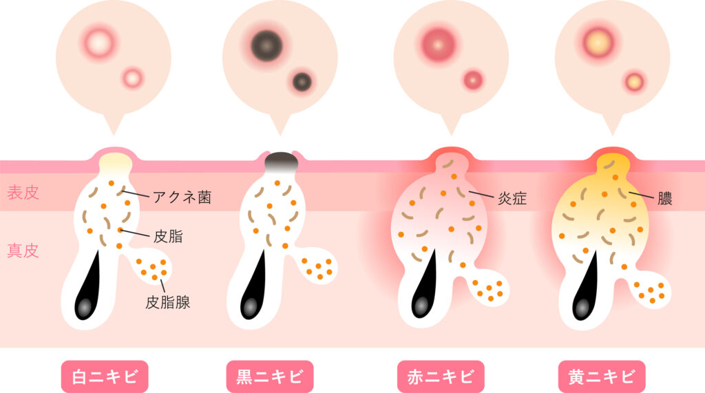症状